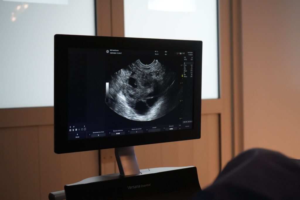 Seguimiento de proceso de fertilidad